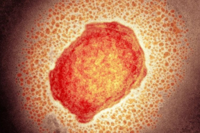 Нужно ли переживать из-за нового вируса оспы, как им заразиться и насколько он опасен