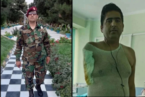 Бывшему сотруднику Минобороны Афганистана ампутировали руку после избиений в Беларуси — СМИ