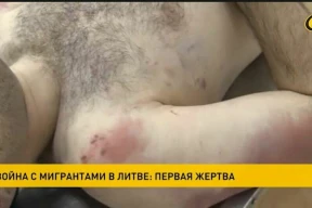 «Па гэтым відэа я не магу на 100% сказаць, што паказваюць труп»